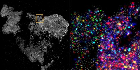A black and white image of a group of cells, next to a close up with vivid fluorescent colors