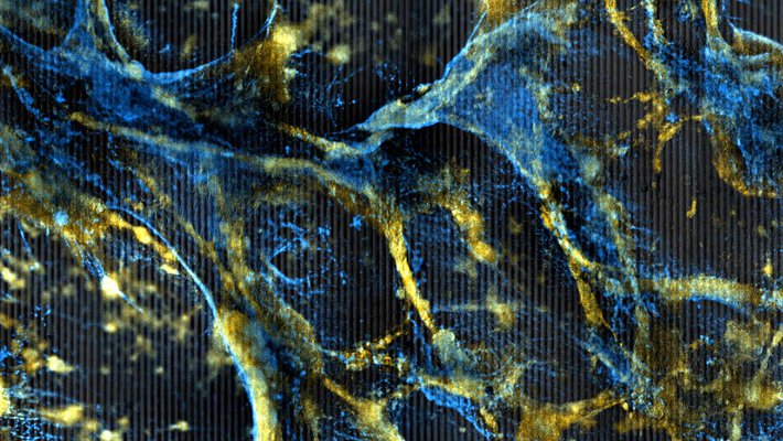 A web of orange cells tangled with a thin blue matrix