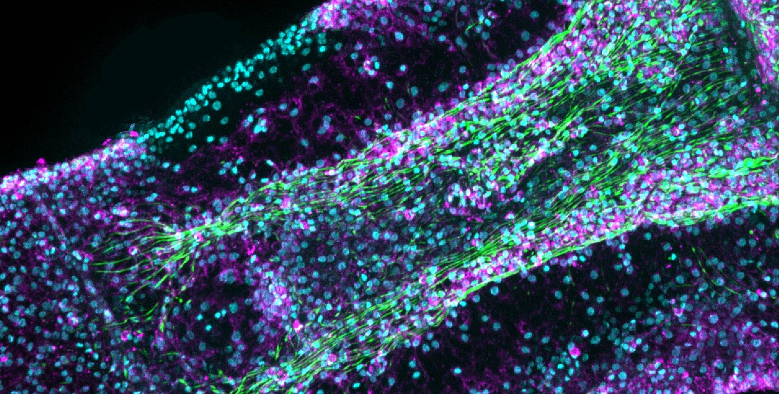 A close up shot of a jellyfish arm with cells labeled in purple and teal