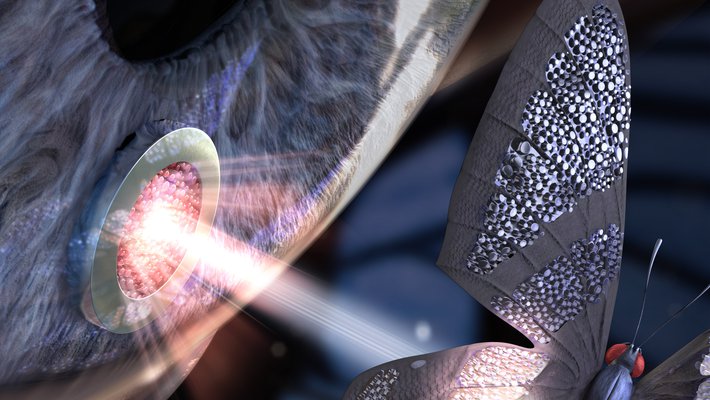 Eye implant