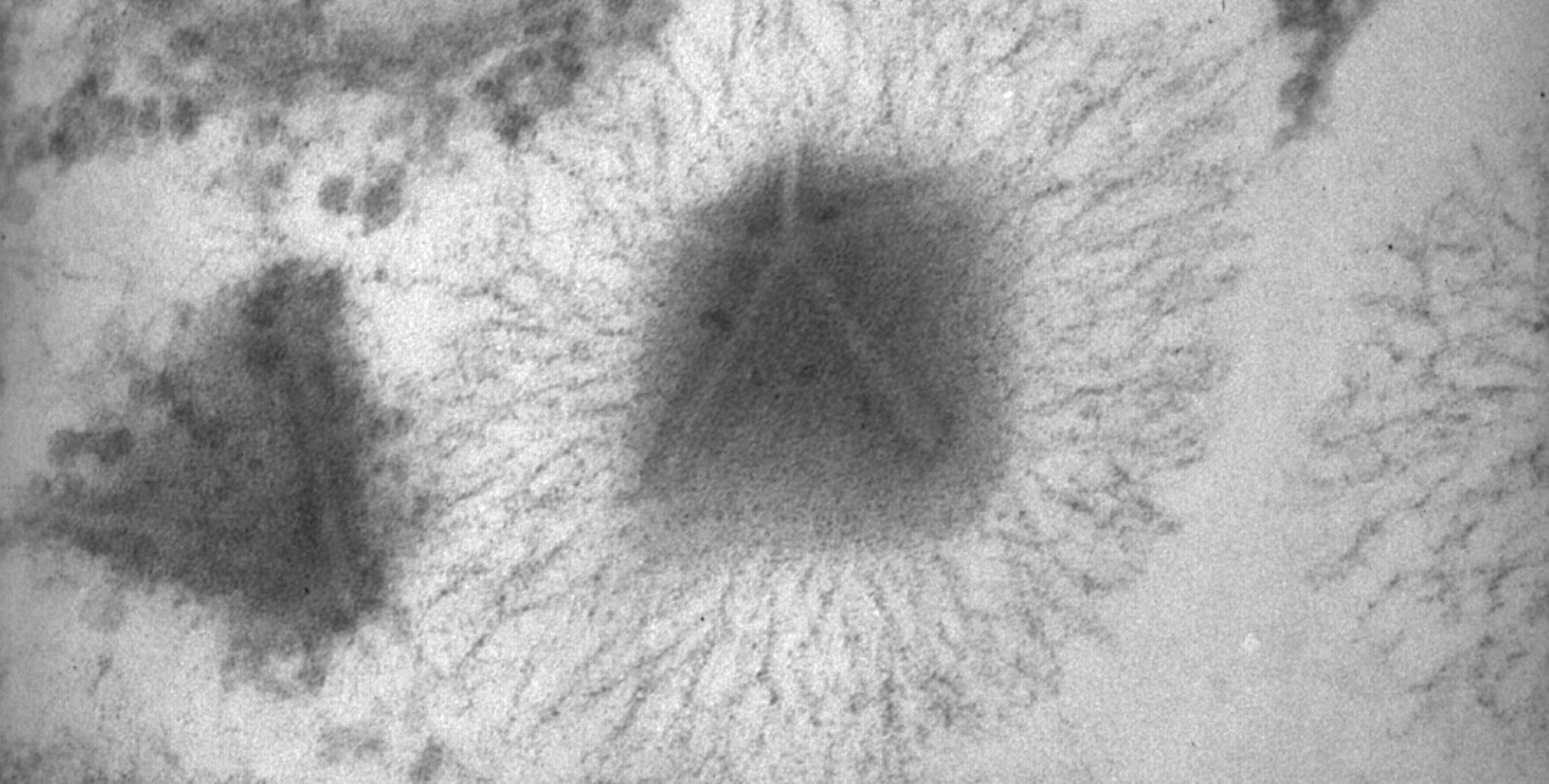 A black and white transmission electron microscopy image of a mimivirus exhibiting the distinctive stargate structure