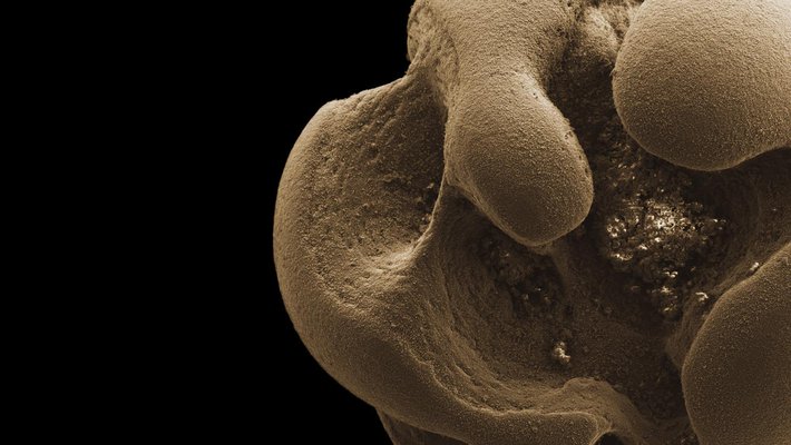 Scanning electron micrograph of manganese nodule.
