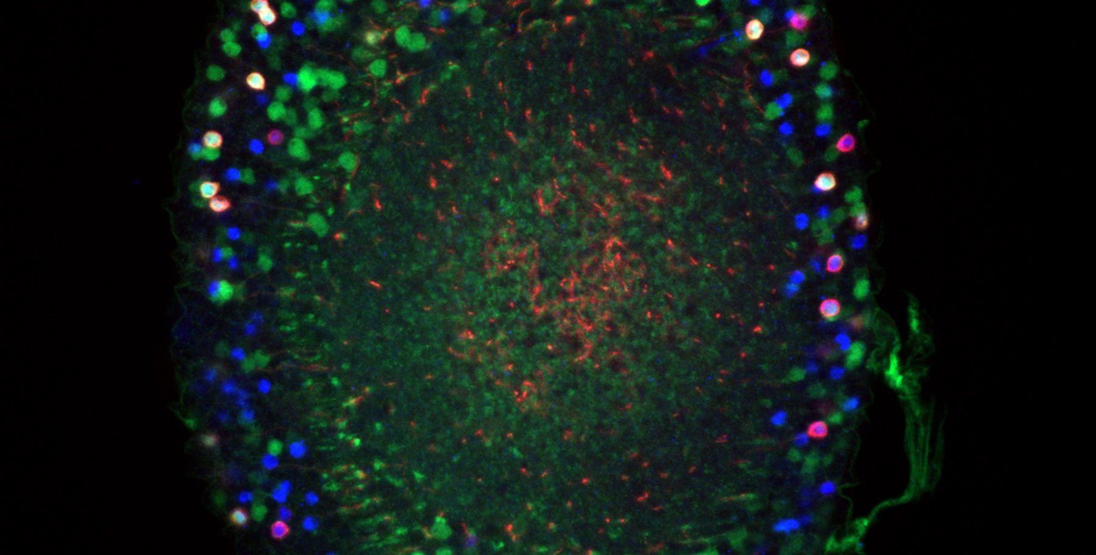 Colorful cells in the adult Drosophila medullary cortex