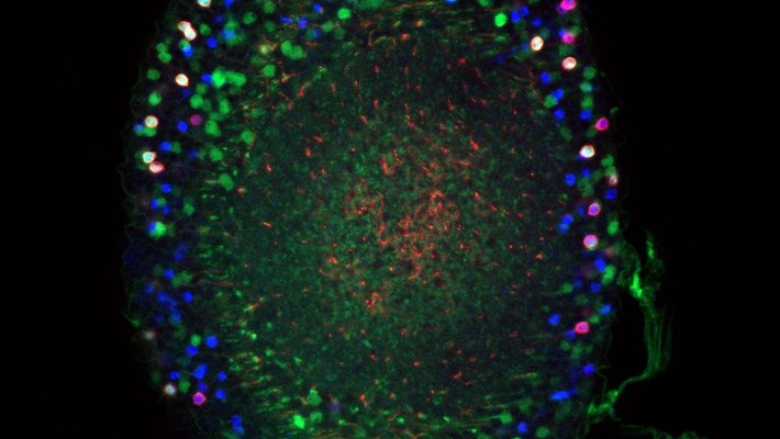 Colorful cells in the adult Drosophila medullary cortex