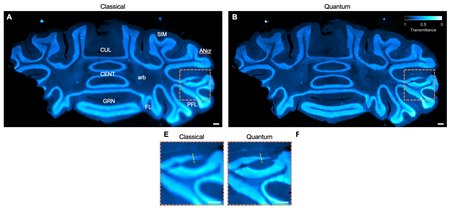 Mouse brain slices show in glowing blue. The images that show quantum imaging are clearer.