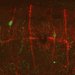Migratory neuroblasts (embryonic nerve cells) traveling across spinal nerves (red) to reach the gut.