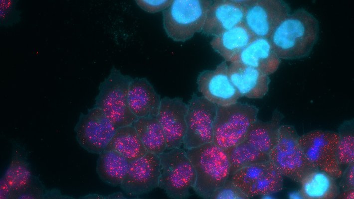 MEMOIR cells