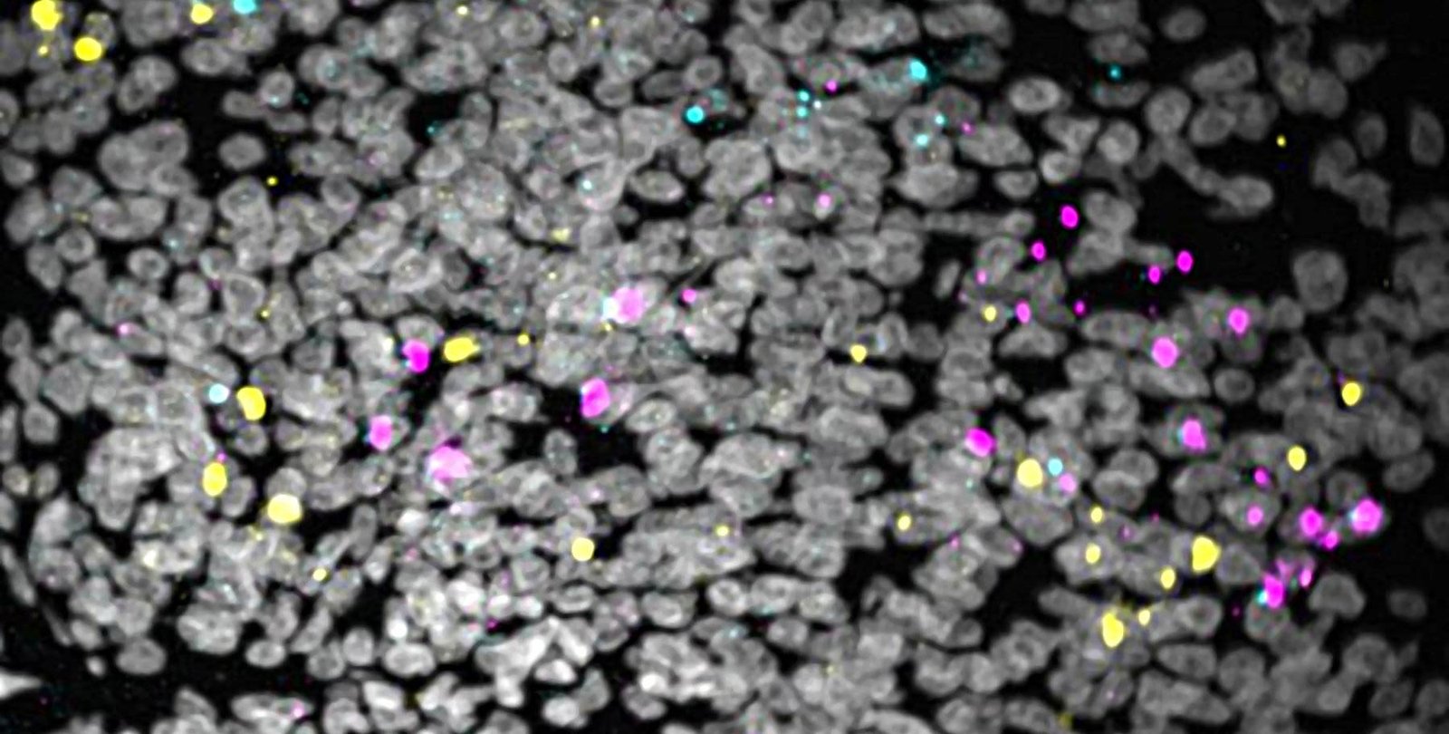 Image of cells glowing with colorful markers