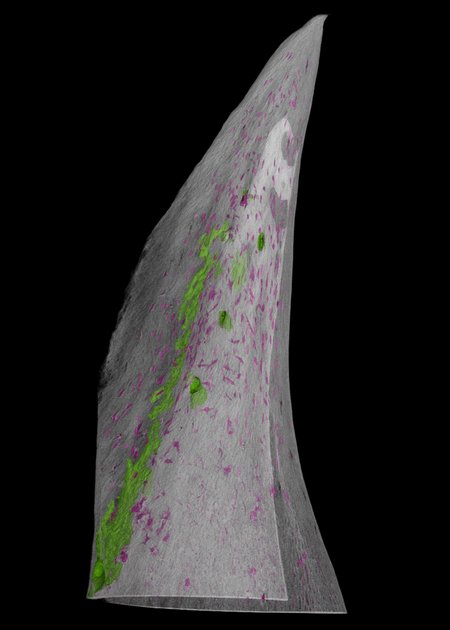 A triangle shaped scale withe green and magenta dots distributed throughout.