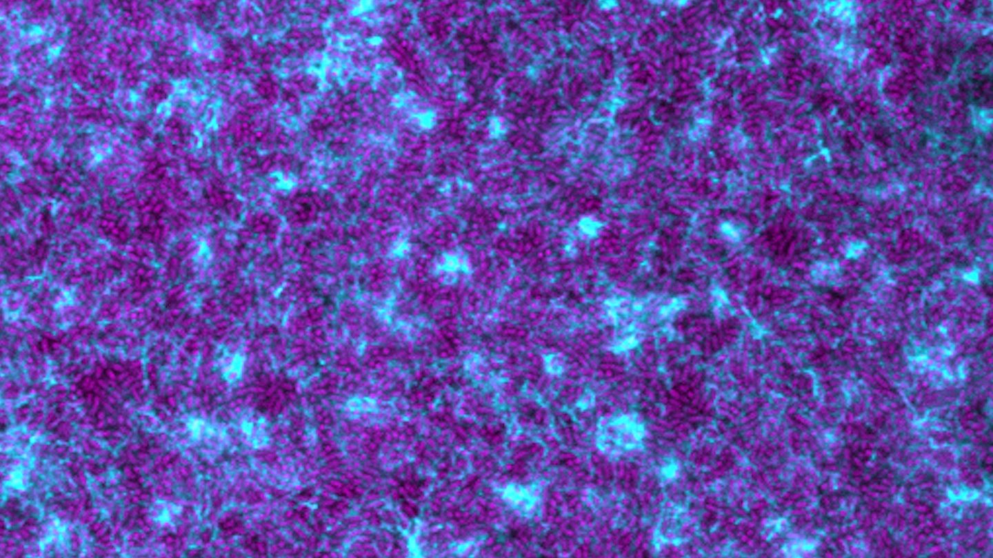 Many purple pill shapes among a web of blue