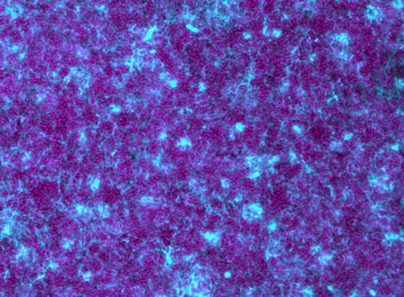 Many purple pill shapes among a web of blue