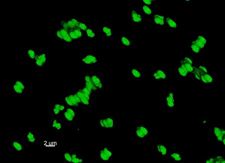 Particles in the small intestinal fluid of mice