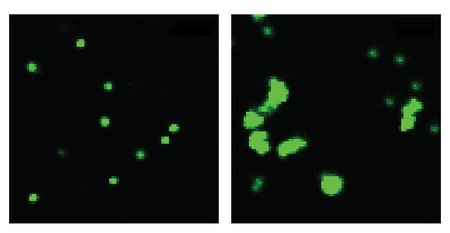 Comparison of long and short fiber in mice small intestine