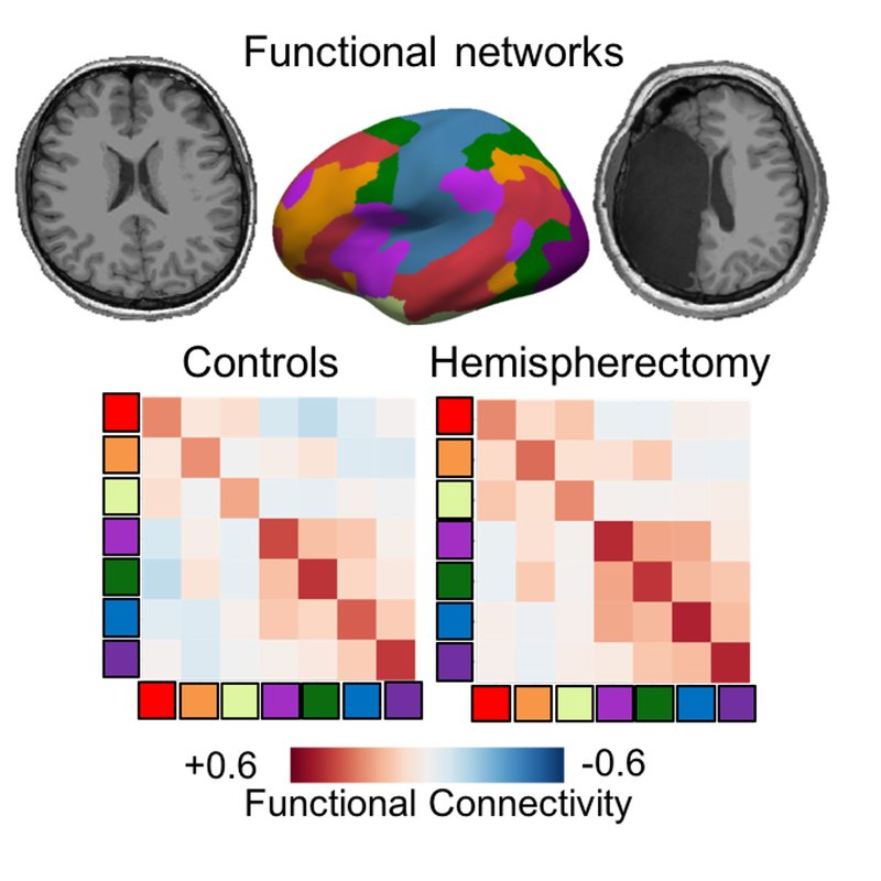 Graphical abstract
