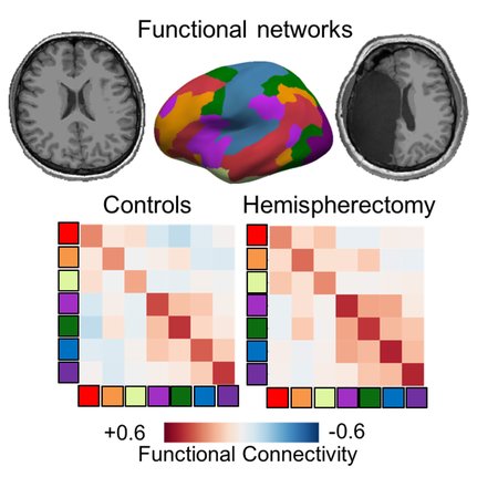 Graphical abstract