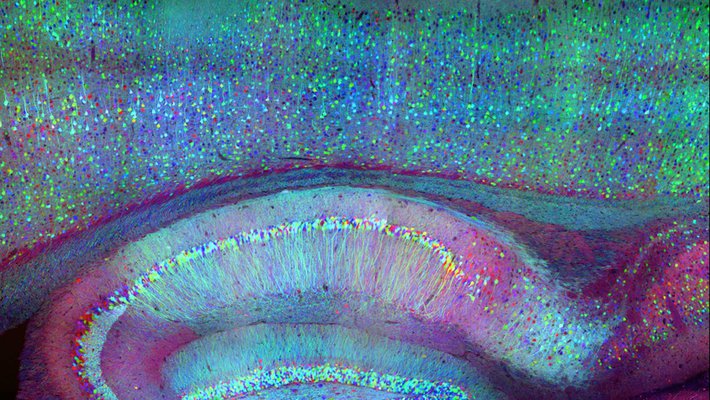 Brain image
