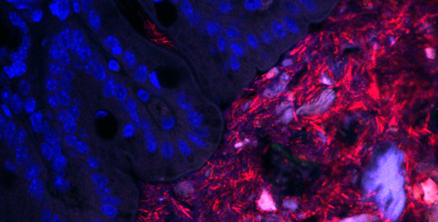 An image of bacteria within a mouse colon