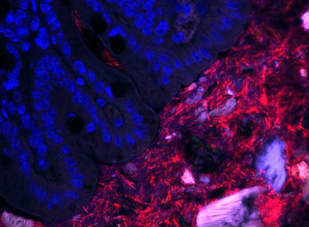 An image of bacteria within a mouse colon