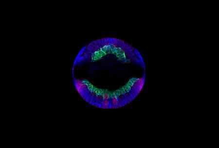 A cross section of a fruit fly embryo