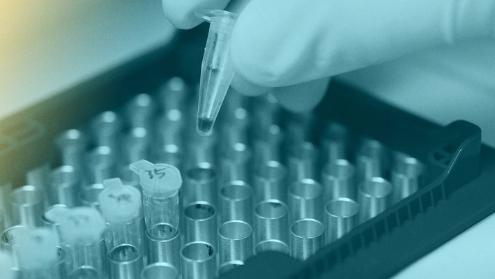 yellow and blue filtered photograph of a tray of sample vials and a gloved hand