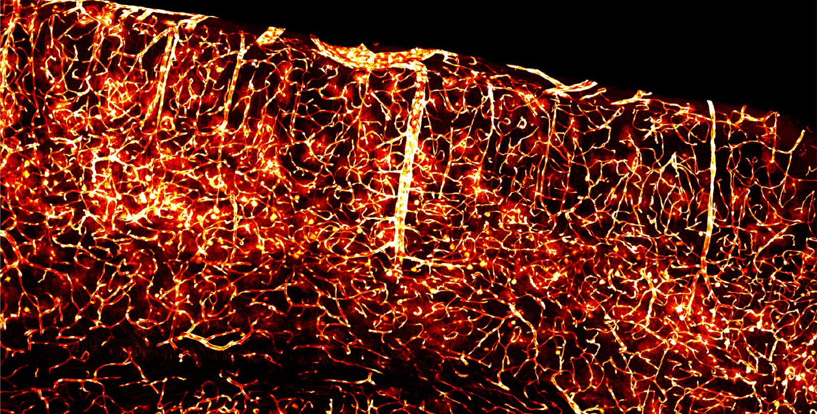 Glowing brain vasculature is made possible through