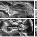 Two larger black and white microscopy images are shown, a mouse brain cross-section and a mouse heart cross-section, with four smaller images that are zoomed in images showing more detail.