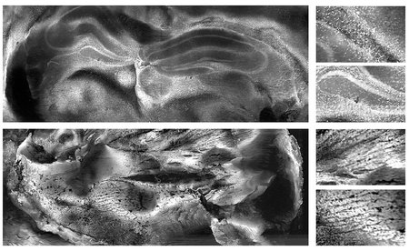 Two larger black and white microscopy images are shown, a mouse brain cross-section and a mouse heart cross-section, with four smaller images that are zoomed in images showing more detail.