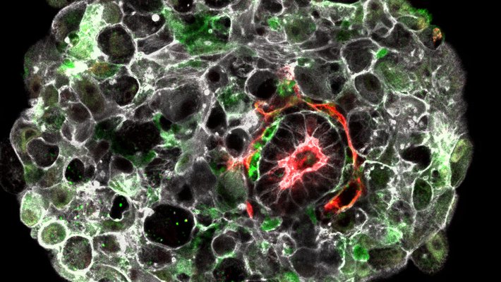A human embryo