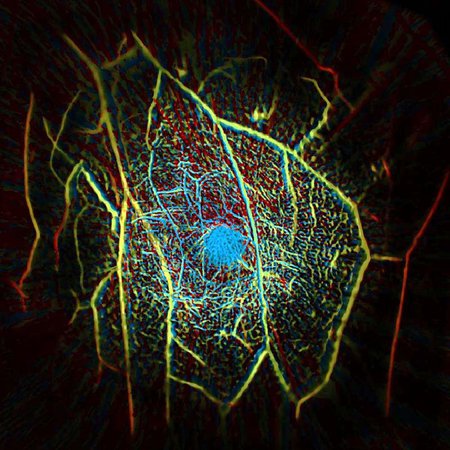 A false-color image of blood vessels within human-breast tissue. 