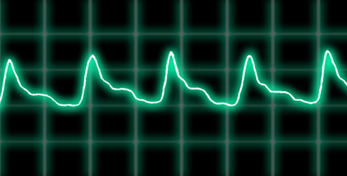 An artist's rendering of a heartbeat plotted on a graph.