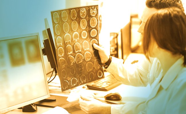 A photo of two researchers analyzing a sheet of brain scan images (likely MRIs) in a lab setting, with a duotone color filter overlaying teal and orange tones.