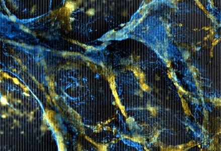 Microscopic close-up of a web-like structure in blue and gold hues, featuring an intricate, fibrous network on a textured background.