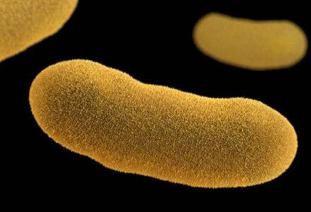 Image of several yellow, fuzzy, rod-shaped bacteria floating against a black background.