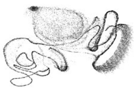 Zebra finch bird song patterns: top shows original, middle shows degradation after neuronal silencing, and bottom shows restoration after brain rewiring.
