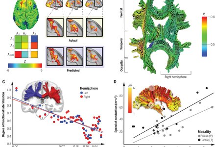 Visualization of brain connectivity and lateralization.