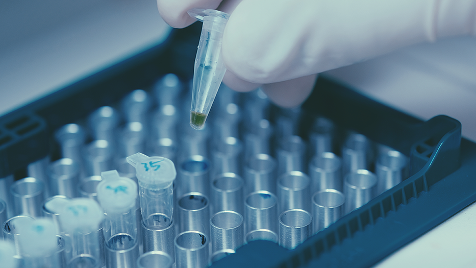 Gloved hand inserting a sample into a tray of samples in a lab