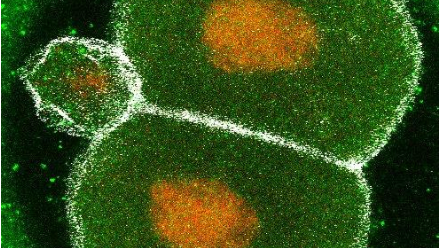 mouse-first pluripotent cellsMAGDA