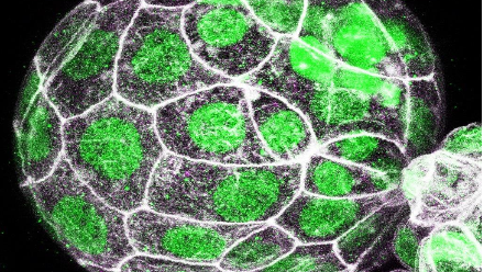 Mouse hatching blastocyst