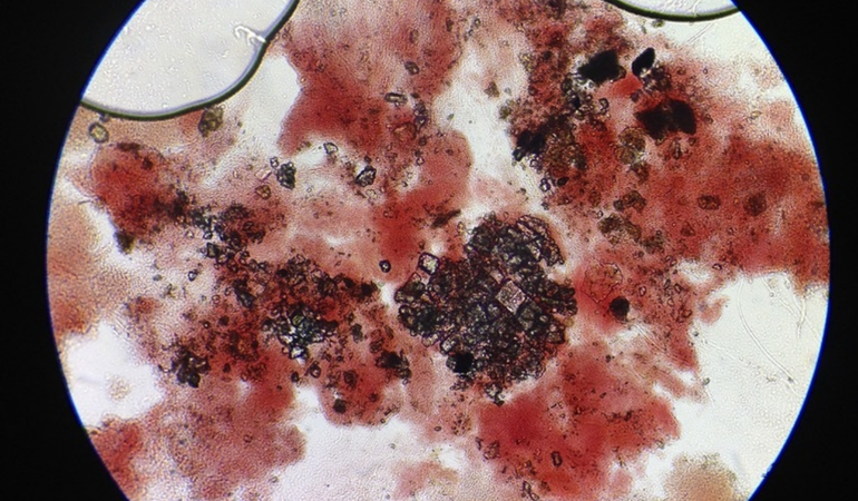 microscpoe