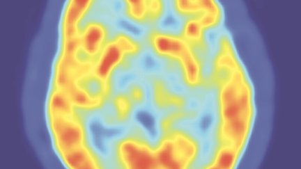 Brain scan