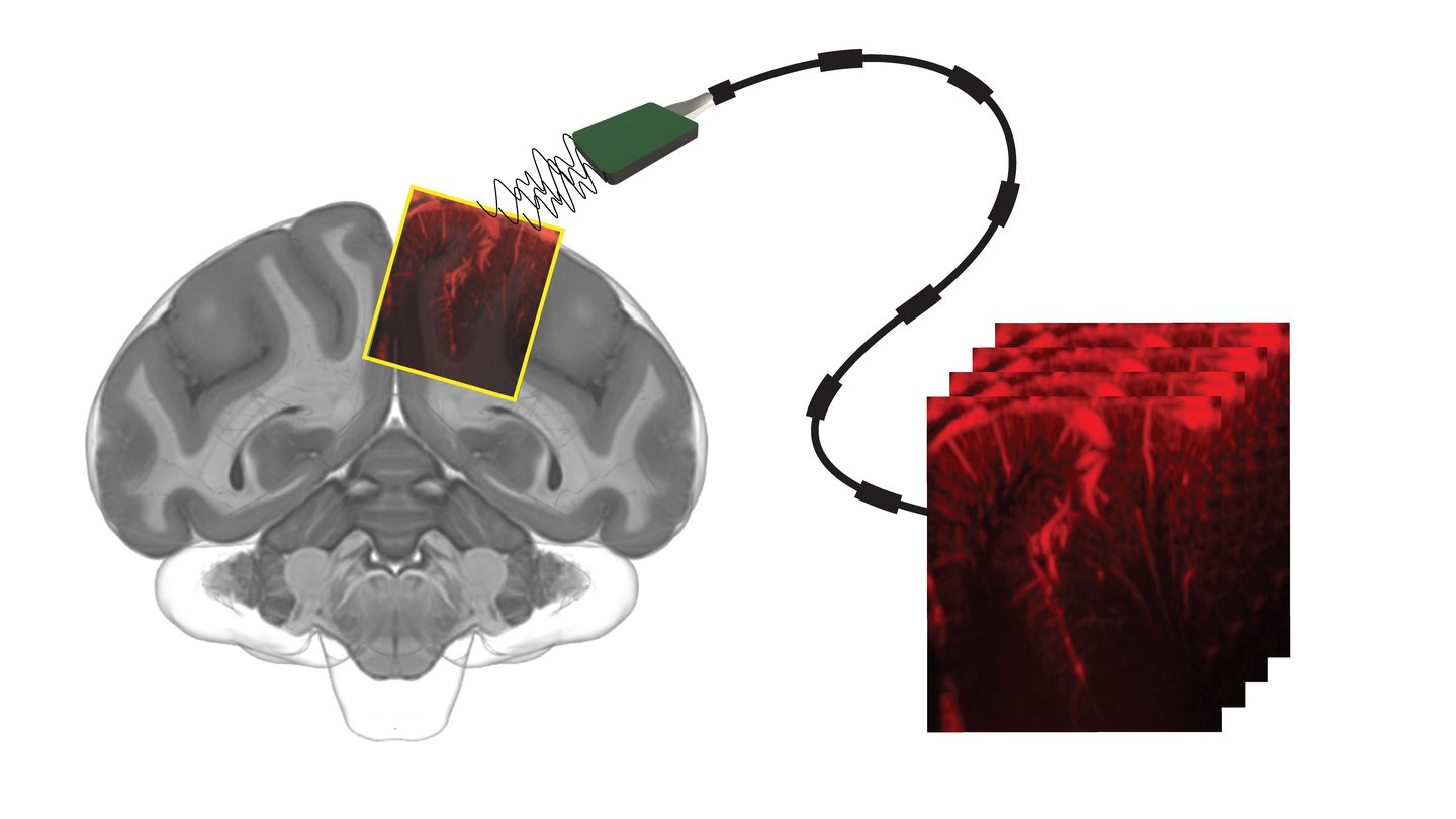 fUS Imaging