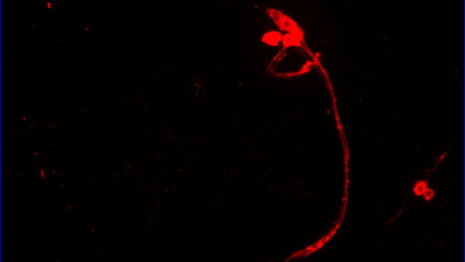 C. elegans L1 sensory neurons stained with DiI