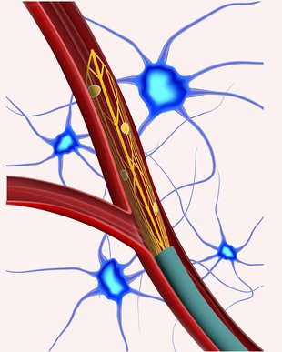 Endovascular neural interfaces